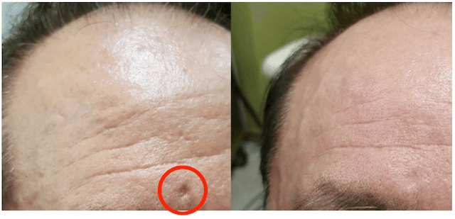 ジュベルック画像