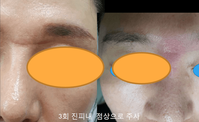 ジュベルック画像