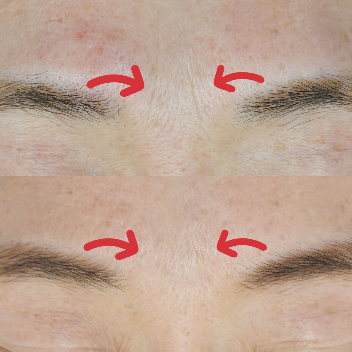 ジュベルック画像