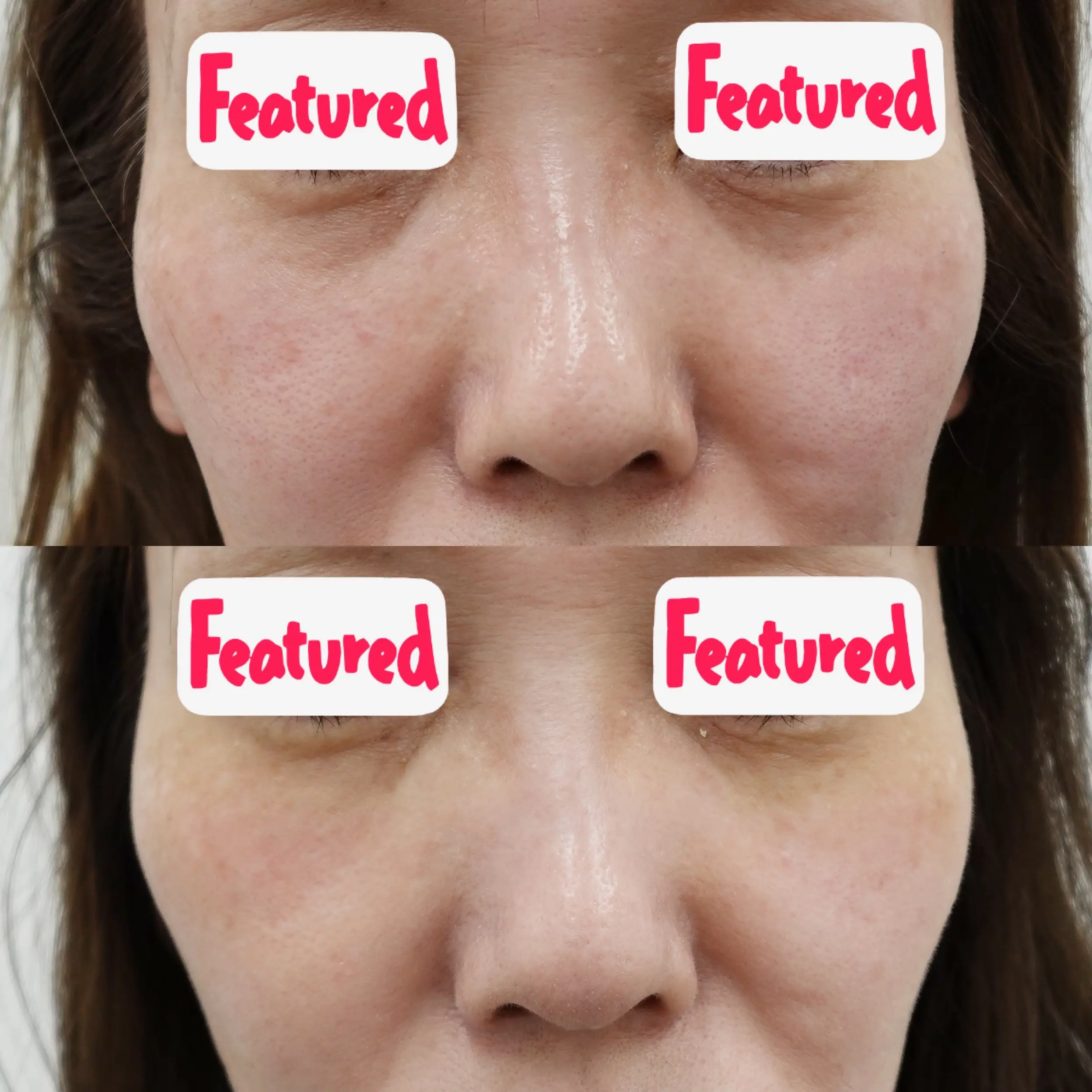 目の下のクマ画像