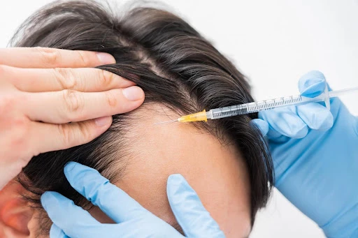 ミノキシジル注射薬と外用薬の違い