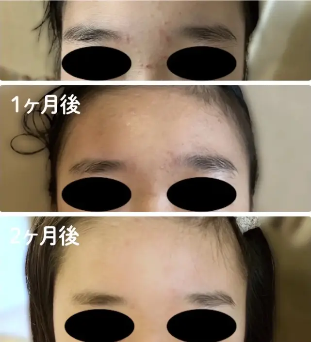 ナイアシンアミド