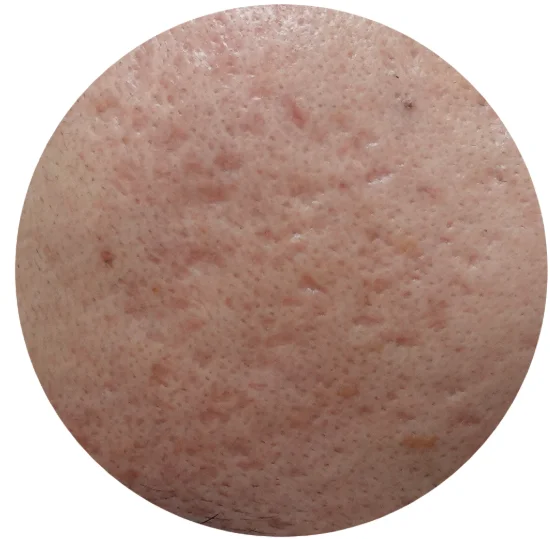 ボックスカー型