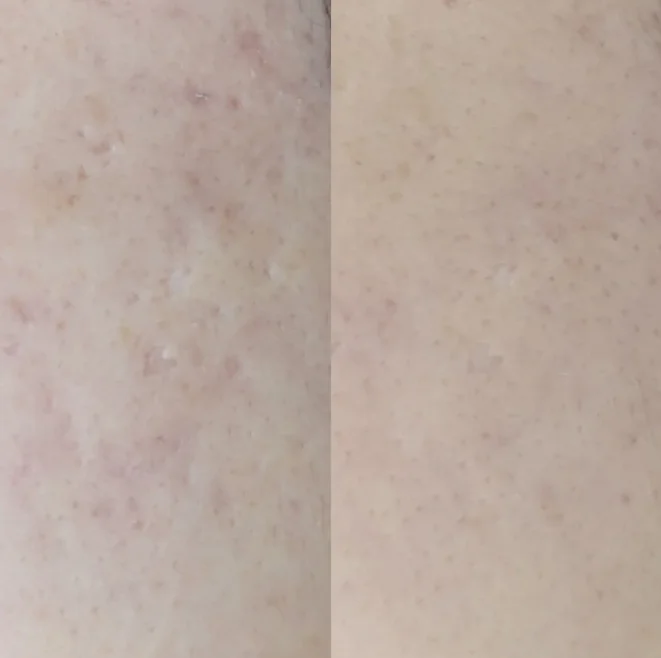 トライフィルプロ画像