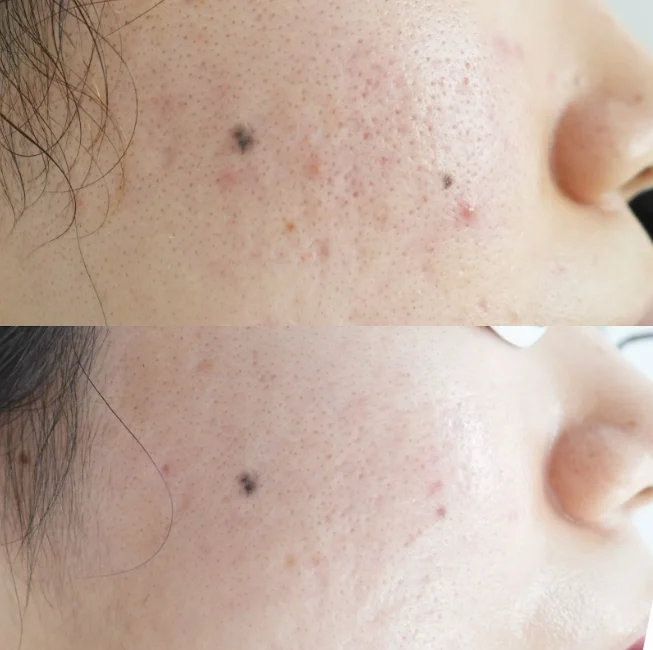 トライフィルプロ画像