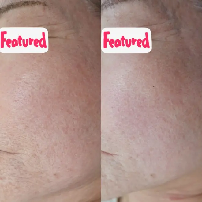 トライフィルプロ画像